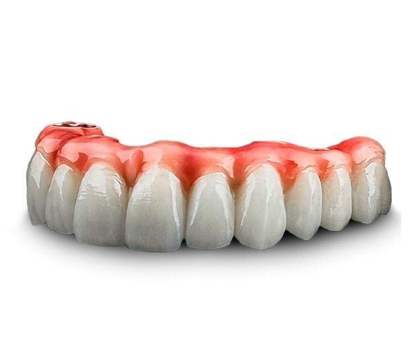 Prótese Protocolo sobre implantes